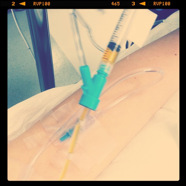Cancer Chronicles - IVs